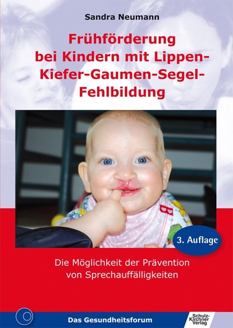 Frühförderung bei Kindern mit Lippen-Kiefer-Gaumen-Segel-Fehlbildung - Sandra Neumann