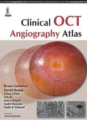 Clinical OCT Angiography Atlas - Bruno Lumbroso, David Huang, Ching J Chen, Yali Jia, Marco Rispoli