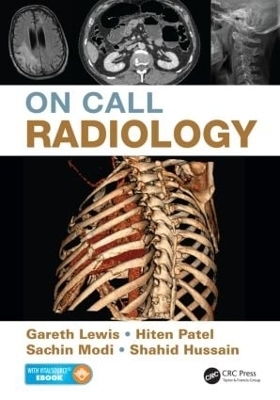 On Call Radiology - Gareth Lewis, Sachin Modi, Hiten Patel, Shahid Hussain