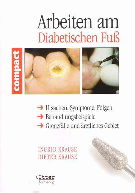 Arbeiten am Diabetischen Fuss - Ingrid Krause, Ingrid Paul-Füssl