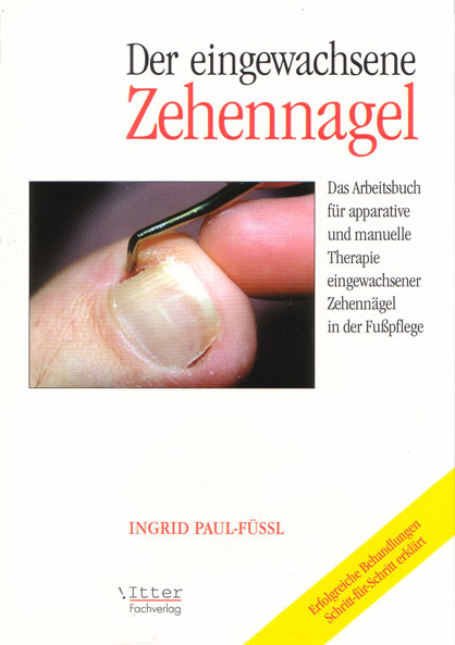 Der eingewachsene Zehennagel - Ingrid Krause, Ingrid Paul-Füssl