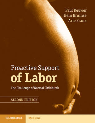 Proactive Support of Labor - Paul Reuwer, Hein Bruinse, Arie Franx