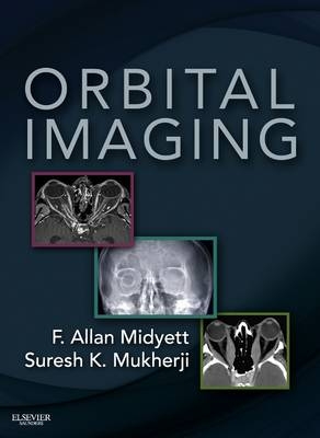 Orbital Imaging E-Book - F Allan Midyett, Suresh Kumar Mukherji