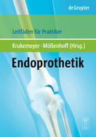 Endoprothetik - 