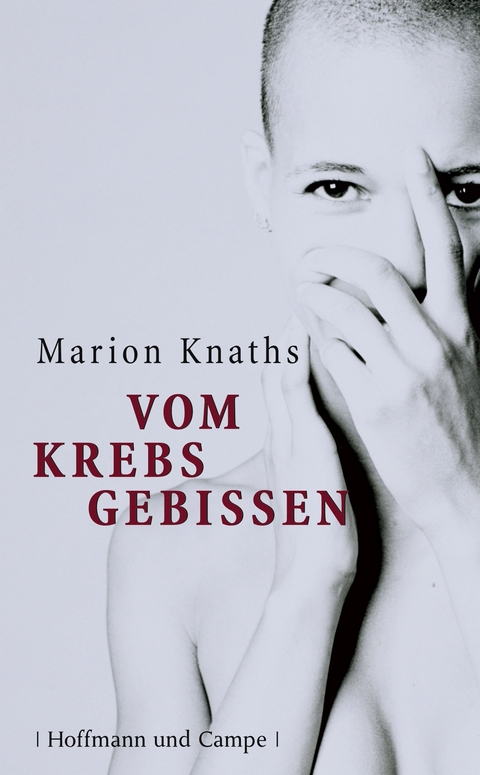 Vom Krebs gebissen - Marion Knaths