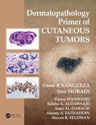 Dermatopathology Primer of Cutaneous Tumors - 