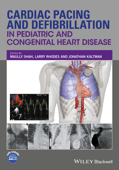 Cardiac Pacing and Defibrillation in Pediatric and Congenital Heart Disease - 