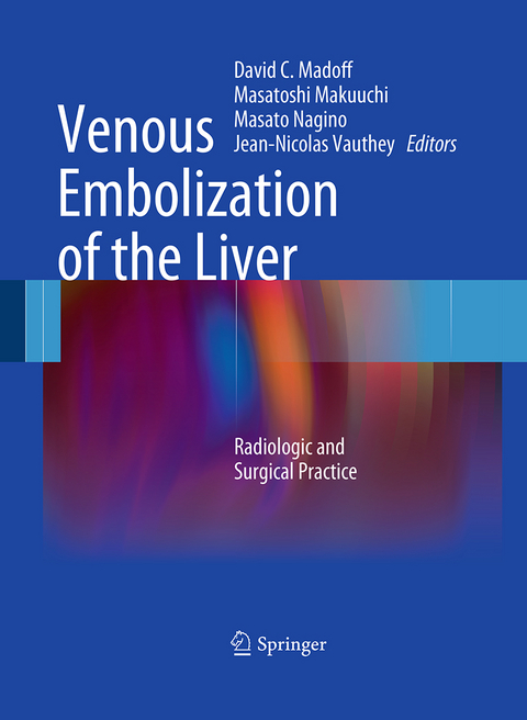 Venous Embolization of the Liver - 