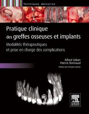 Pratique Clinique Des Greffes Osseuses Et Implants - Alfred Seban, Patrick Bonnaud
