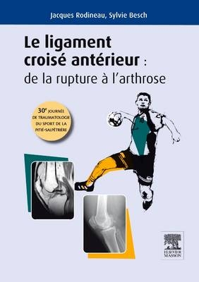 Ligament Croise Anterieur