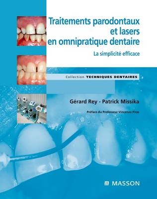 Traitements Parodontaux Et Lasers En Omnipratique Dentaire - Gerard Rey, Patrick Missika