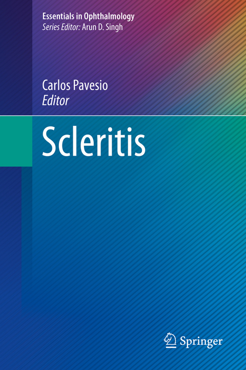 Scleritis - 