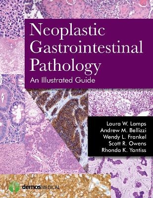 Neoplastic Gastrointestinal Pathology - Laura W. Lamps, Andrew M. Bellizzi, Wendy L. Frankel, Scott R. Owens, Rhonda K. Yantiss