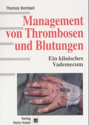 Management von Thrombosen und Blutungen - Thomas Bombeli