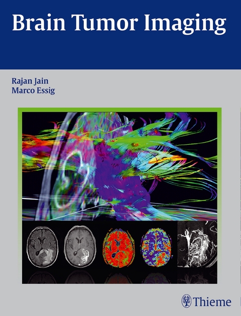 Brain Tumor Imaging - Rajan Jain, Marco Essig