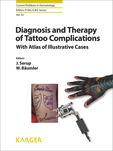 Diagnosis and Therapy of Tattoo Complications - 