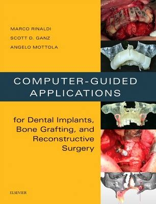 Computer-Guided Applications for Dental Implants, Bone Grafting, and Reconstructive Surgery (adapted translation) - Marco Rinaldi, Scott D Ganz, Angelo Mottola