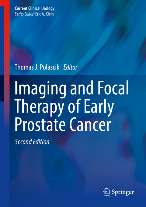 Imaging and Focal Therapy of Early Prostate Cancer - 