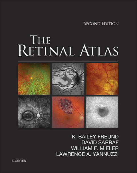 The Retinal Atlas E-Book -  K. Bailey Freund,  David Sarraf,  William F. Mieler,  Lawrence A. Yannuzzi