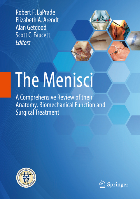 The Menisci - 