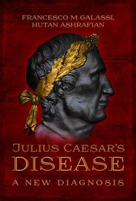 Julius Caesar's Disease -  Hutan Ashrafian,  Francesco M. Galassi