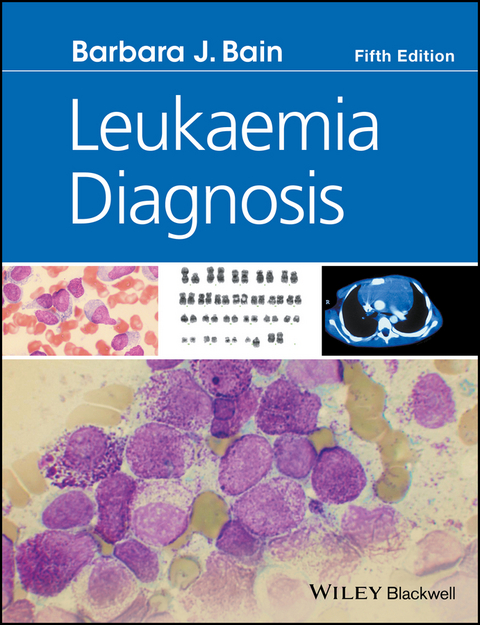 Leukaemia Diagnosis -  Barbara J. Bain