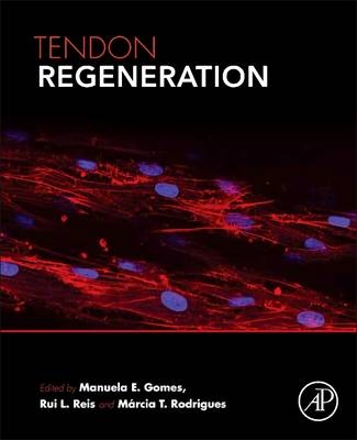 Tendon Regeneration - 