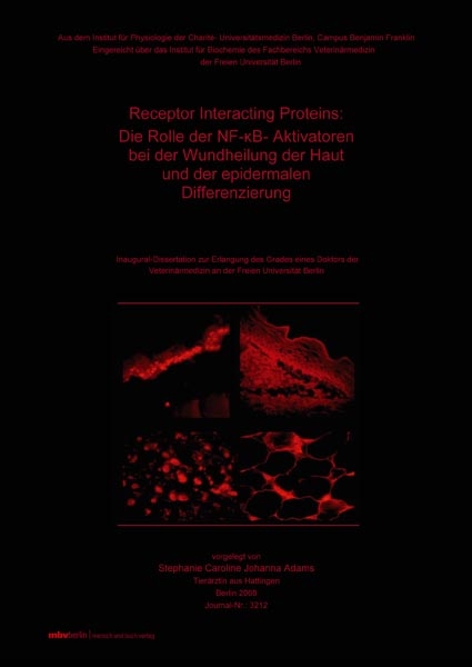 Receptor Interacting Proteins : Die Rolle der NF-(kappa)B-Aktivatoren bei der Wundheilung der Haut und der epidermalen Differenzierung - Stephanie Adams