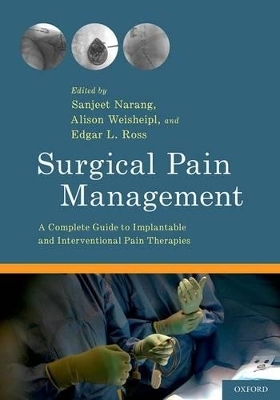 Surgical Pain Management - 