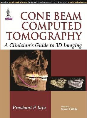 Cone Beam Computed Tomography - Prashant P Jaju