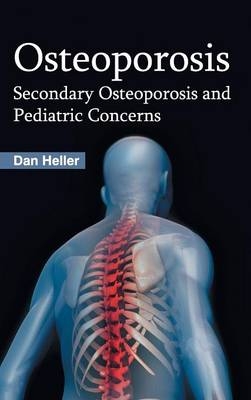 Osteoporosis: Secondary Osteoporosis and Pediatric Concerns - 