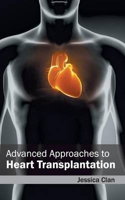 Advanced Approaches to Heart Transplantation - 