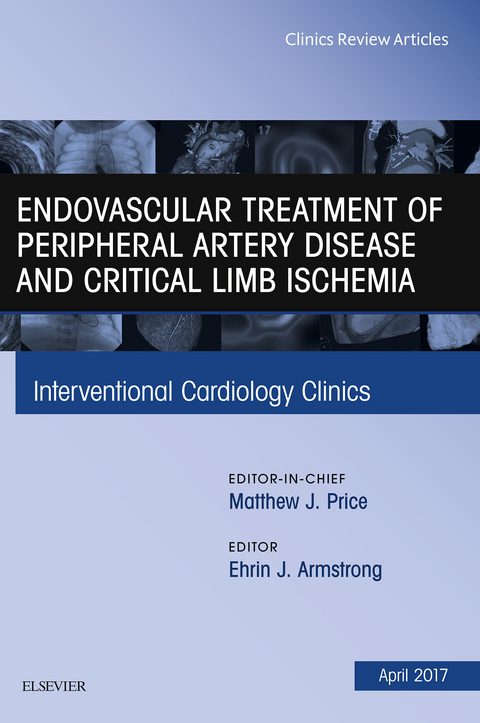 Endovascular Treatment of Peripheral Artery Disease and Critical Limb Ischemia, An Issue of Interventional Cardiology Clinics -  Ehrin J. Armstrong