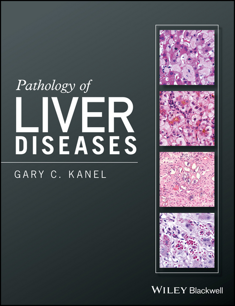 Pathology of Liver Diseases -  Gary C. Kanel