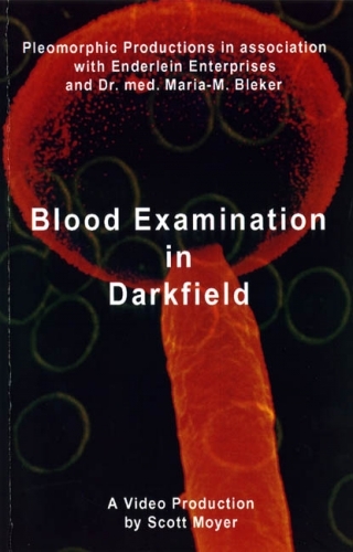 Blood Examination in darkfield - Maria M Bleker
