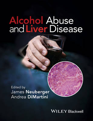 Alcohol Abuse and Liver Disease - Andrea DiMartini