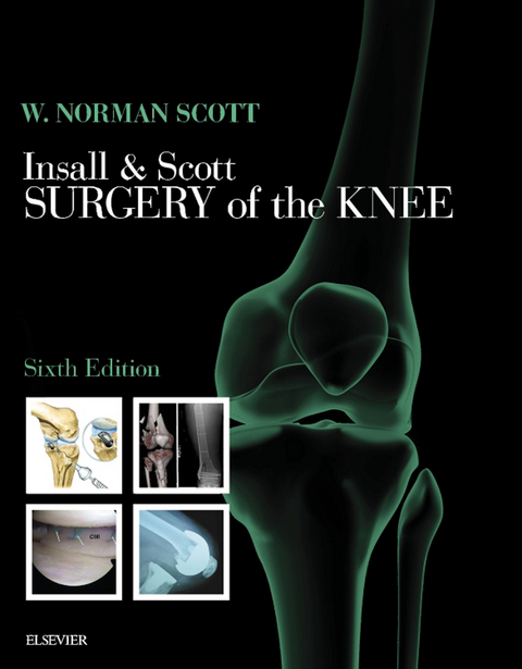 Insall & Scott Surgery of the Knee -  W. Norman Scott