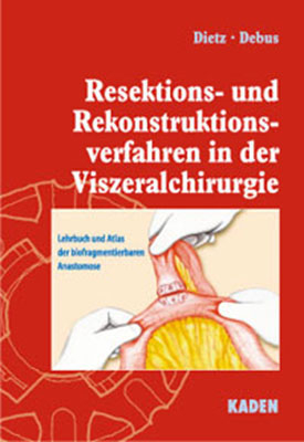 Resektions- und Rekonstruktionsverfahren in der Viszeralchirurgie - Ulrich A Dietz, Eike S Debus