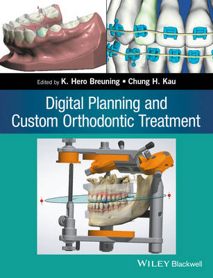 Digital Planning and Custom Orthodontic Treatment - 