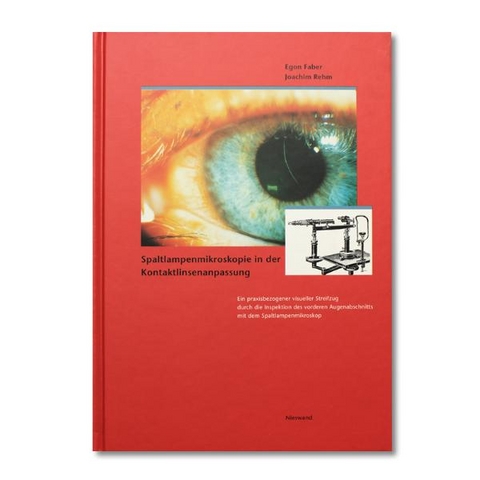 Spaltlampenmikroskopie in der Kontaktlinsenanpassung - Egon Faber, Joachim Rehm