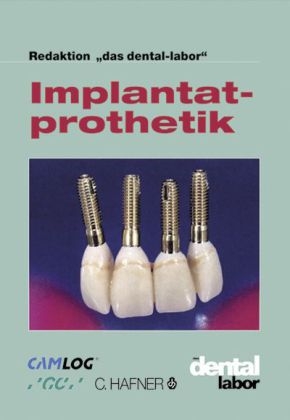 Implantatprothetik - 