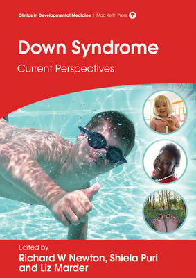 Down Syndrome - Richard W. Newton, Liz Marder, Shiela C. Puri