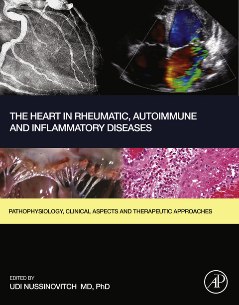 Heart in Rheumatic, Autoimmune and Inflammatory Diseases - 