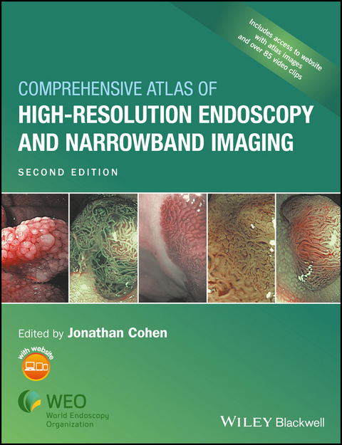 Comprehensive Atlas of High-Resolution Endoscopy and Narrowband Imaging - 