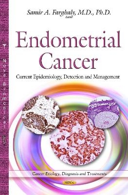 Endometrial Cancer - 