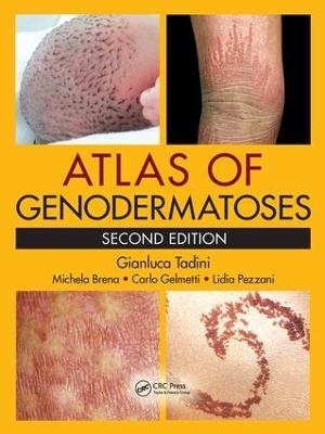 Atlas of Genodermatoses - Gianluca Tadini, Michela Brena, Carlo Gelmetti, Lidia Pezzani