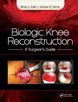 Biologic Knee Reconstruction - Brian Cole, Joshua Harris