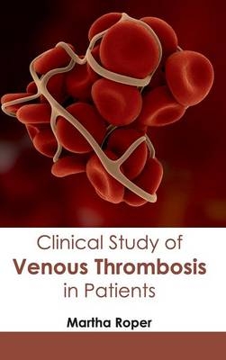 Clinical Study of Venous Thrombosis in Patients - 