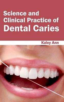 Science and Clinical Practice of Dental Caries - 