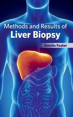 Methods and Results of Liver Biopsy - 